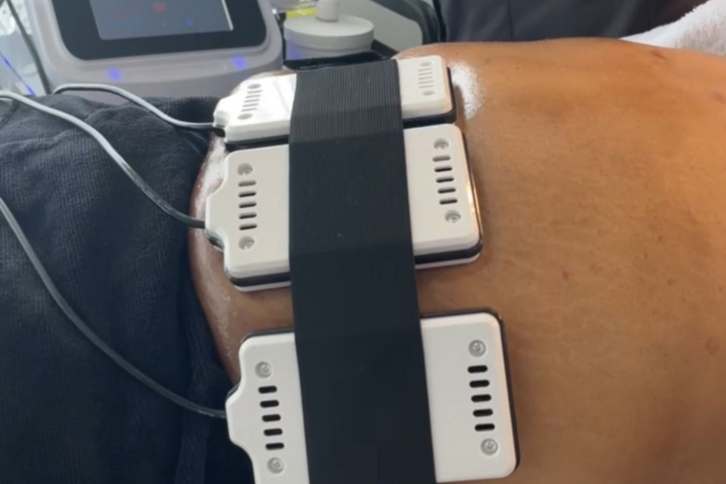 Brazilian Body Sculpting