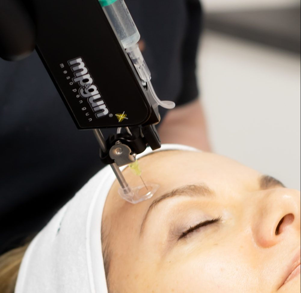 Mesotherapie Skinbooster