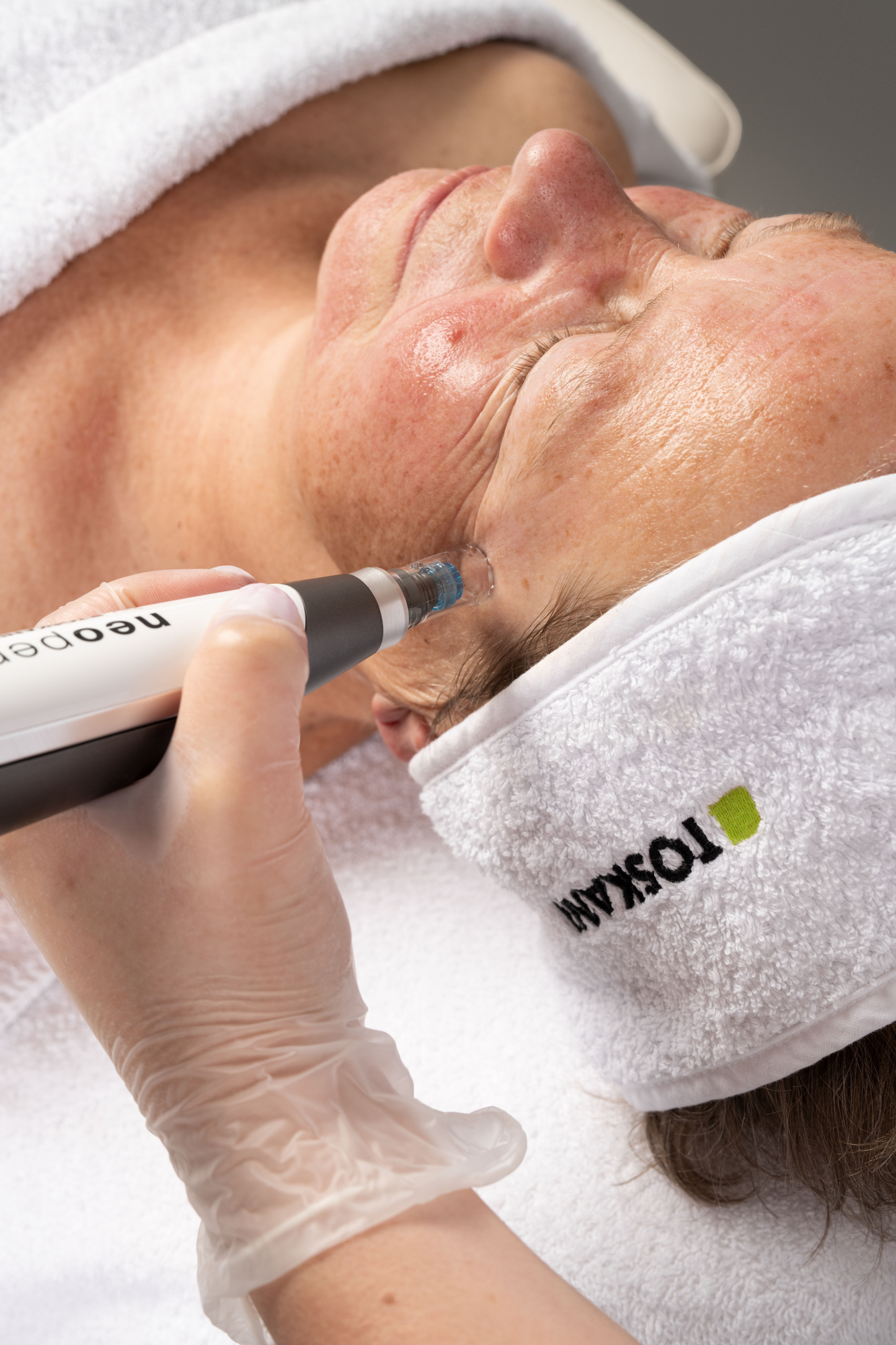 Dermapen® Microneedling