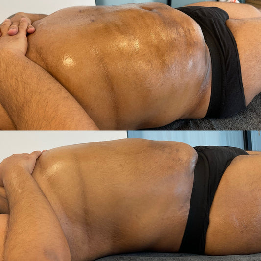 Brazilian Vacuum fit therapy